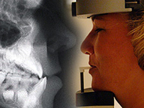 ceph xray